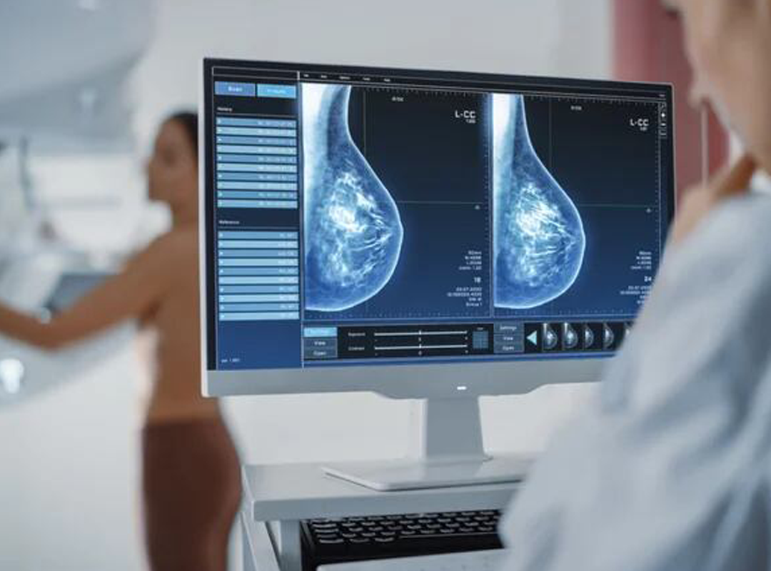 Crioablación de Nitrógeno Líquido para Cáncer de Mama