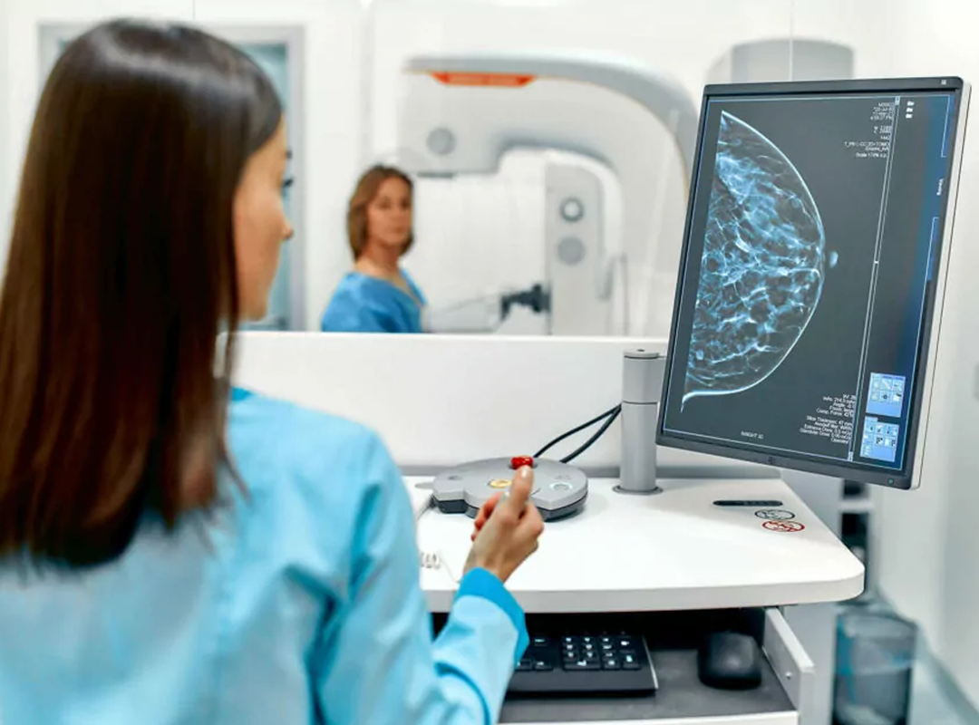4 mitos sobre las mamografías que debes conocer