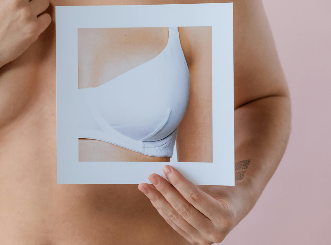 Prevención del carcinoma mamario